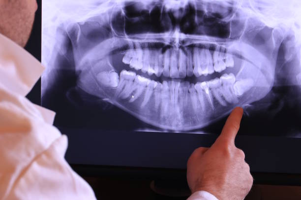 Best Emergency Wisdom Teeth Removal in Colorado City, AZ